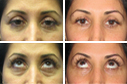 Before & After Photos